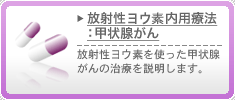 放射性ヨウ素内用療法：甲状腺がん　放射性ヨウ素を使った甲状腺がんの治療を説明します。